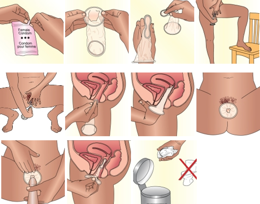A GUIDE ON HOW TO USE CONDOM PERFECTLY 